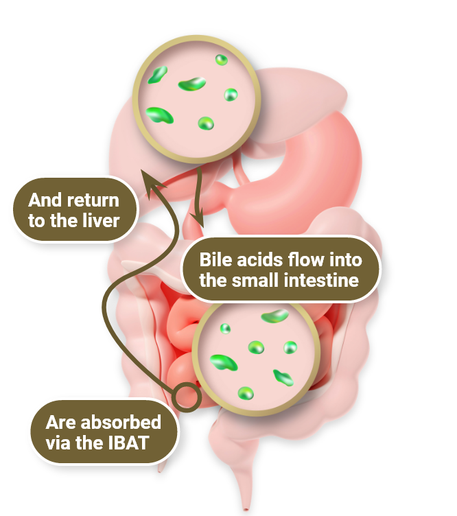 Arrows show the way bile acids flow into the small intestines, get absorbed by the IBAT, and return to the liver in a healthy person  (134)
