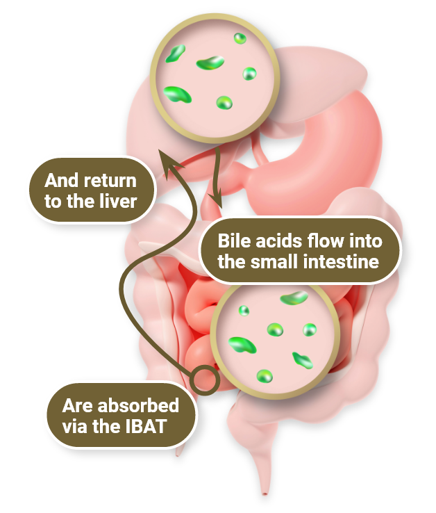 Arrows show the way bile acids flow into the small intestines, get absorbed by the IBAT, and return to the liver in a healthy person