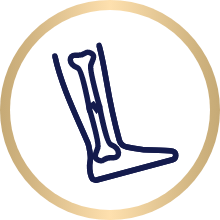 Icon showing a fractured bone inside the outline of a leg